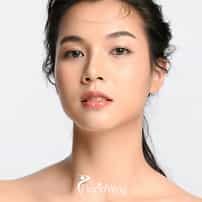 Reasons Why Patients Choose Philippines for Plastic Surgery: A Complete Guide